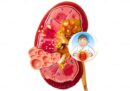 Thận Âm Hư là gì? Cách nhận biết, Bồi bổ và Phân biệt với Thận Dương