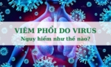 Bạn có biết Viêm phổi do virus nguy hiểm như thế nào?