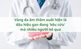 Vàng da âm thầm xuất hiện là dấu hiệu gan đang ‘kêu cứu’ mà nhiều người bỏ qua