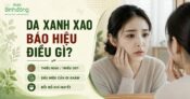 Da xanh xao là bị gì? Nguyên nhân, Giải pháp cải thiện làn da nhợt nhạt