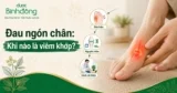 Viêm khớp ngón chân: Dấu hiệu, nguyên nhân và cách cải thiện