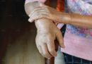 Đau nhức xương khớp là gì? Nguyên nhân, Cảnh báo, Điều trị và Giảm đau tại nhà