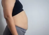 Đầy hơi chướng bụng: Giảm khó chịu và ngăn ngừa tái phát