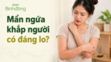 Mẩn ngứa khắp người: 6 nguyên nhân thường gặp và cách giảm an toàn