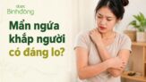 Mẩn ngứa khắp người: 6 nguyên nhân thường gặp và cách giảm an toàn