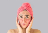 Nổi mẩn ngứa ở mặt là bệnh gì? Nguyên nhân, Chẩn đoán, Điều trị