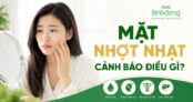Mặt nhợt nhạt, xanh xao kéo dài: Khi nào cần lo và nên làm gì?