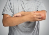 Ngứa về đêm là bệnh gì? Nguyên nhân, Giải pháp giúp bạn có giấc ngủ ngon hơn