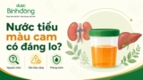 Nước tiểu màu cam có sao không? Nguyên nhân, Chẩn đoán, Xử lý