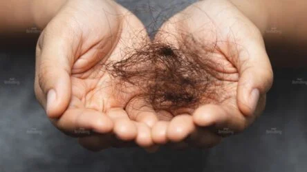 Rụng tóc tuổi dậy thì: Khi nào là rụng tóc sinh lý, khi nào cần đi khám?