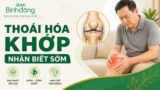 Thoái hóa khớp là gì? Dấu hiệu, Nguyên nhân, Điều trị và Giảm đau tại nhà