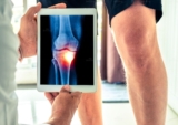 Cách giảm triệu chứng thoái hóa khớp gối tại nhà