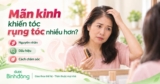 Tóc rụng nhiều ở phụ nữ mãn kinh: Nguyên nhân, dấu hiệu và cách hạn chế ?