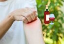 Uống rượu nổi mẩn đỏ phải làm sao? Phương pháp hỗ trợ và điều trị