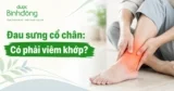 Viêm khớp cổ chân: Cách điều trị và phòng ngừa hiệu quả 