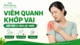 Viêm khớp quanh vai: 4 thể bệnh, Nguyên nhân, dấu hiệu và hướng điều trị
