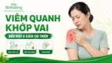 Viêm khớp quanh vai: 4 thể bệnh, Nguyên nhân, dấu hiệu và hướng điều trị