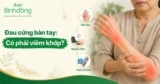 Viêm khớp tay: Nguyên nhân và Phương pháp điều trị hiệu quả
