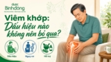 Viêm khớp là gì? Nguyên nhân, Dấu hiệu, Điều trị và Giảm đau tại nhà