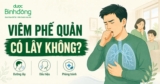 Viêm phế quản có lây không? Dấu hiệu nhận biết, Cách phòng tránh