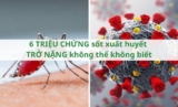 ​6 triệu chứng sốt xuất huyết trở nặng không thể không biết
